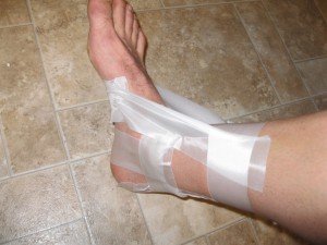 night splints for feet